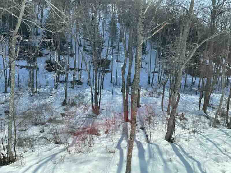 【お客様の声/Customer Feedback】緊張がほぐれるよう話してくれた-the way he spoke to me helped me relax and release my tension